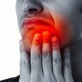 Jaw Problems and Bruxism (Teeth Grinding): Symptoms