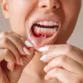 Gum Diseases: Symptoms, Treatment, and Prevention Methods