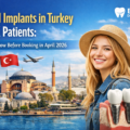 Dental Implants in Turkey for UK Patients: What to Know Before Booking in April 2026