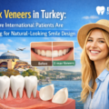E-Max Veneers in Turkey: Why More International Patients are Searching for Natural-Looking Smile Design