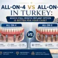 All-on-4 vs All-on-6 in Turkey: Which Full-Mouth Implant Option is Better for You?